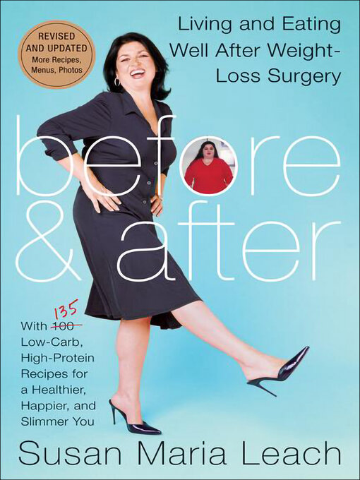 Title details for Before & After by Susan Maria Leach - Available